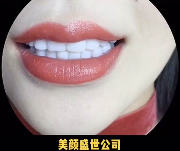南京瓷贴片美牙技术培训课程